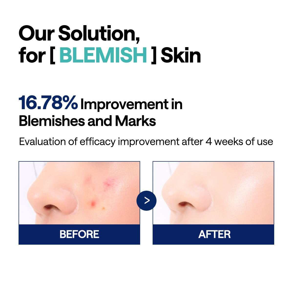 Before and after comparison of blemish skin with text about solution improvement.