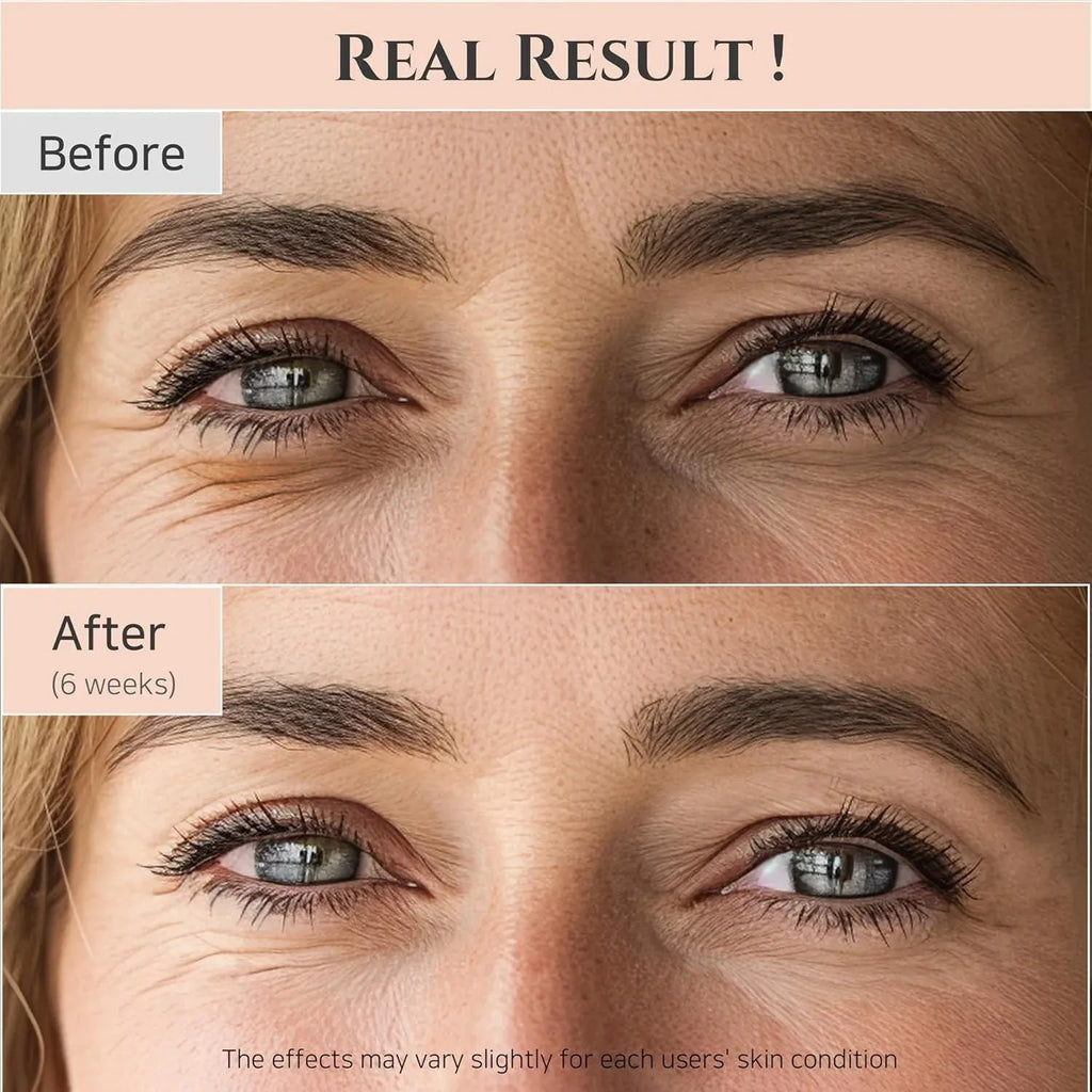 BeautyOfJoseon — BeautyOfJoseon Revive Eye Serum Ginseng + Retinal 30ml